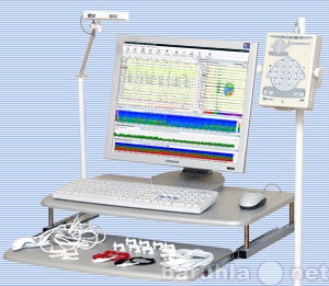 Продам: ЭЭГ - Электроэнцефалография