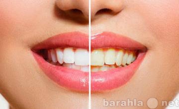Продам: Эффективная система отбеливания зубов