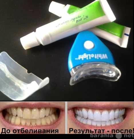 Предложение: Отбеливание зубов в домашних условиях