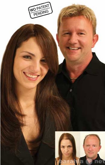 Предложение: Замещение волос при алопеции HAIRWEAR