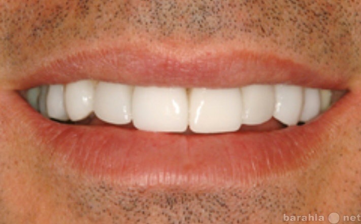 Предложение: Съёмный протез зубов. Cтоматологическая