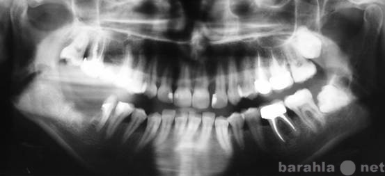 Предложение: Ортопантомограмма зубов