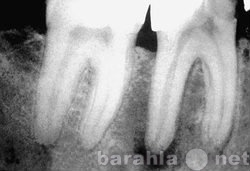 Предложение: Рентгеновский снимок зубов