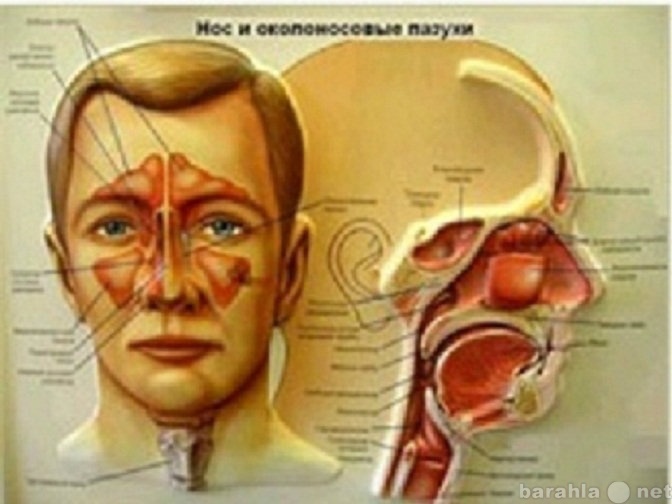 Предложение: Лечение гайморита