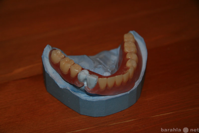 Предложение: Протезирование зубов на дому