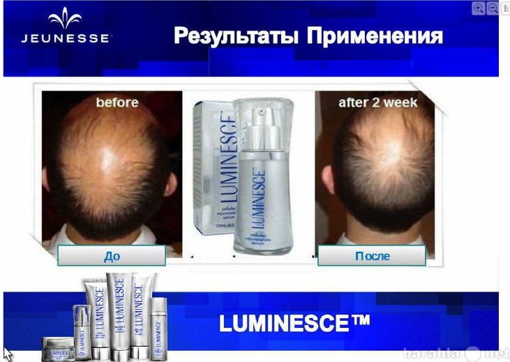 Предложение: лечение ваших волос!