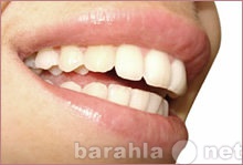 Предложение: Чистка зубов у стоматолога ультразвуком