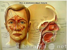 Предложение: Лечение гайморита массажем